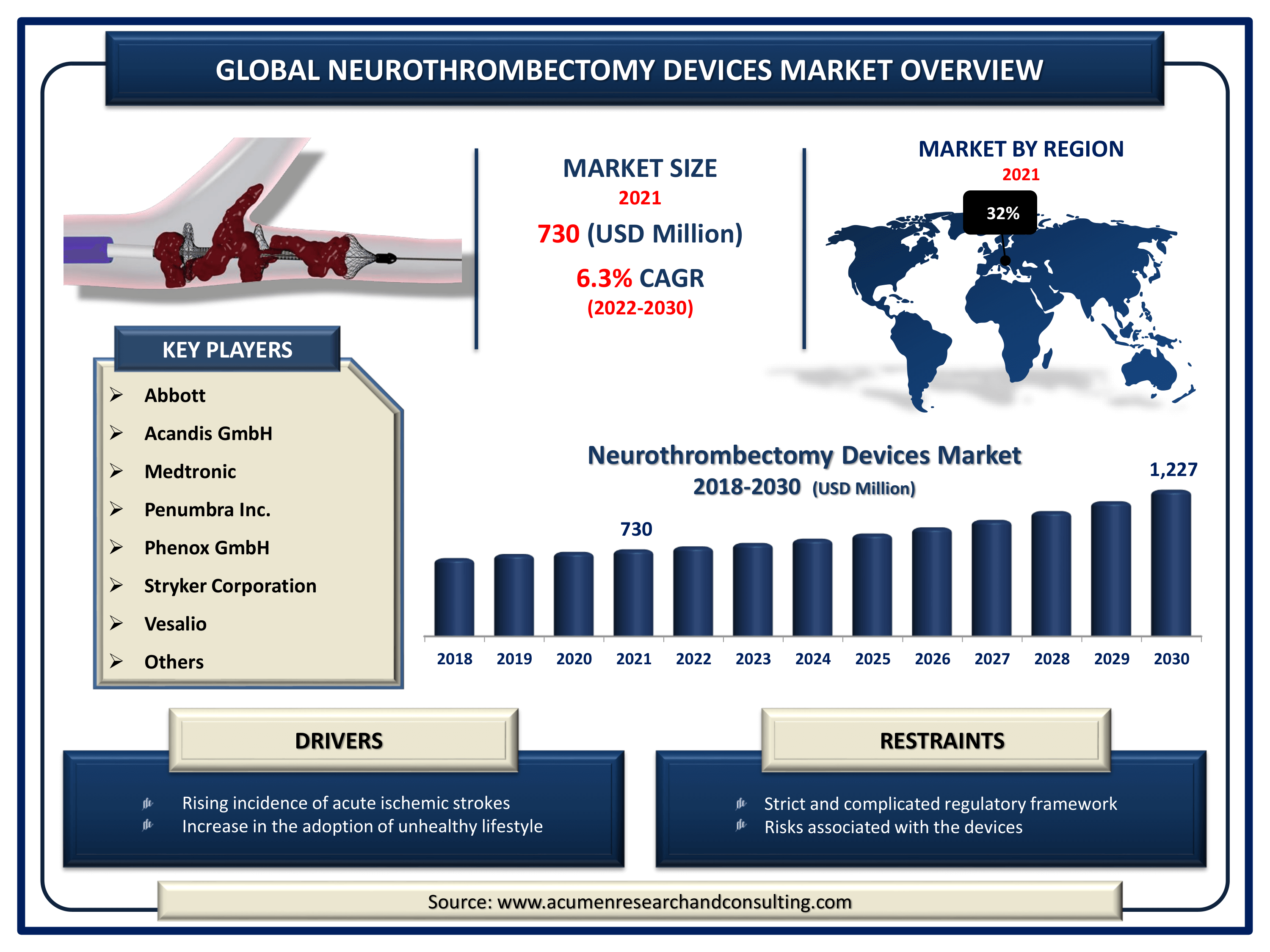 Neurothrombectomy Devices Market Size, Share | Industry Growth - 2030